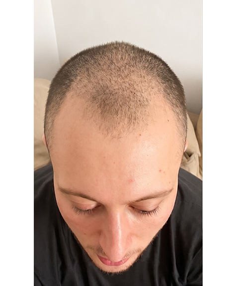 Before